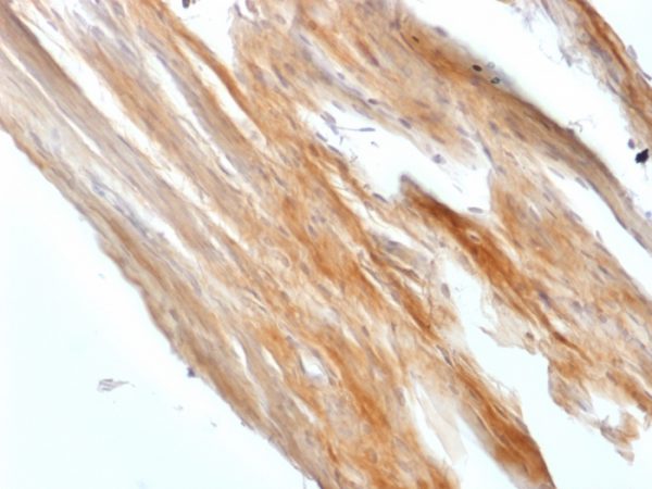 Formalin-fixed, paraffin-embedded Rat Uterus stained with Caldesmon Rabbit Recombinant Monoclonal Antibody (CALD1/1424R).