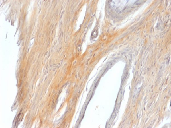 Formalin-fixed, paraffin-embedded Rat Uterus stained with Caldesmon Rabbit Polyclonal Antibody.