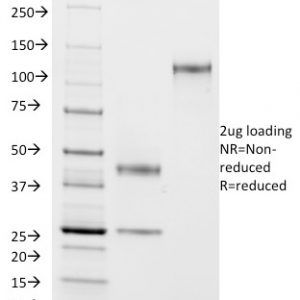 SDS-PAGE Analysis of Purified ASRGL1 Mouse Monoclonal Antibody (CRASH/1290). Confirmation of Purity and Integrity of Antibody.
