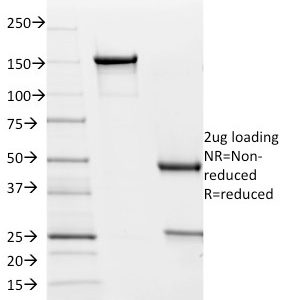SDS-PAGE Analysis of Purified PD-L2 Mouse Monoclonal Antibody (Z64P2D3*H4). Confirmation of Purity and Integrity of Antibody.