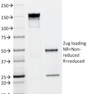 SDS-PAGE Analysis of Purified FGF23 Mouse Monoclonal antibody (FGF23/638). Confirmation of Purity and Integrity of Antibody.