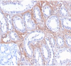 Formalin-fixed, paraffin-embedded human kidney stained with FGF23 Mouse Monoclonal Antibody (FGF23/4171) at 2ug/ml. Inset: PBS instead of primary antibody; secondary only negative control.