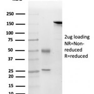 SDS-PAGE Analysis of Purified FGF23Mouse Monoclonal Antibody (FGF23/4169). Confirmation of Purity and Integrity of Antibody.