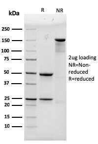SDS-PAGE Analysis Purified ACTN4 Mouse Monoclonal Antibody (93). Confirmation of Purity and Integrity of Antibody.