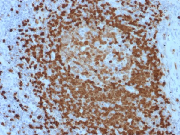 Formalin-fixed, paraffin-embedded human Lymph Node stained with TCL1 Mouse Monoclonal Antibody (TCL1/2079).