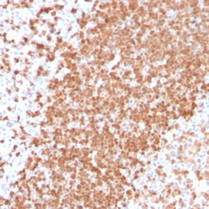 Formalin-fixed, paraffin-embedded human Tonsil stained with TCL1 Recombinant Rabbit Monoclonal Antibody (TCL1/2747R).