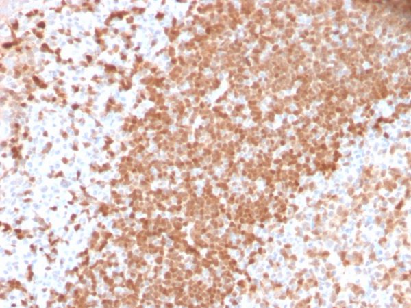 Formalin-fixed, paraffin-embedded human Tonsil stained with TCL1 Recombinant Rabbit Monoclonal Antibody (TCL1/2747R).