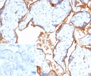 Formalin-fixed, paraffin-embedded human placenta stained with Nectin 4 Mouse Monoclonal Antibody (NECT4/7271). Inset: PBS instead of primary antibody; secondary only negative control.