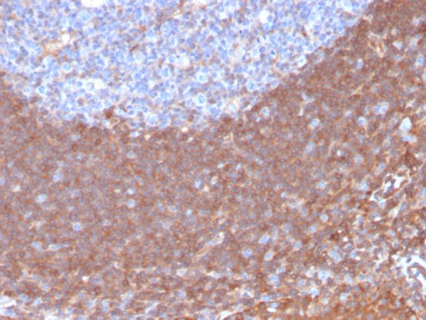 Formalin-fixed, paraffin-embedded human Tonsil stained with Calpastatin Mouse Monoclonal Antibody (CAST/1550).