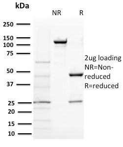 SDS-PAGE Analysis of Purified BAP1 Mouse Monoclonal Antibody (BAP1/2431). Confirmation of Purity and Integrity of Antibody.