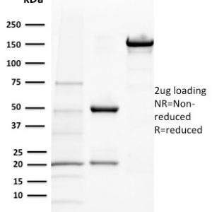 SDS-PAGE Analysis of Purified BAP1 Mouse Monoclonal Antibody (BAP1/2432). Confirmation of Purity and Integrity of Antibody.