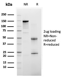 SDS-PAGE Analysis of Purified BAP1 Mouse Monoclonal Antibody (BAP1/2665). Confirmation of Purity and Integrity of Antibody.