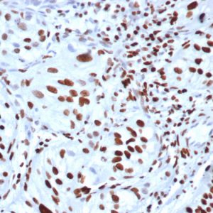 Formalin-fixed, paraffin-embedded human bladder stained with Histone H3 (PHH3) Recombinant Mouse Monoclonal Antibody (rPHH3/6824).