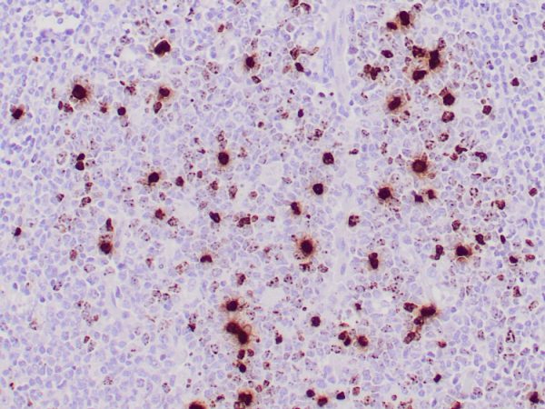 Formalin-fixed, paraffin-embedded human tonsil stained with Histone H3 (PHH3) Recombinant Rabbit Monoclonal Antibody (PHH3/471R).