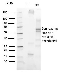 SDS-PAGE Analysis Purified Histone H3 Recombinant Rabbit Monoclonal Antibody (PHH3/471R). Confirmation of Purity and Integrity of Antibody.