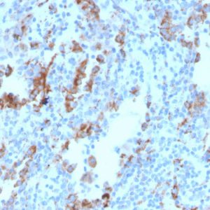 Formalin-fixed, paraffin-embedded human lymph node stained with TIM3 Mouse Monoclonal Antibody (TIM3/4030).