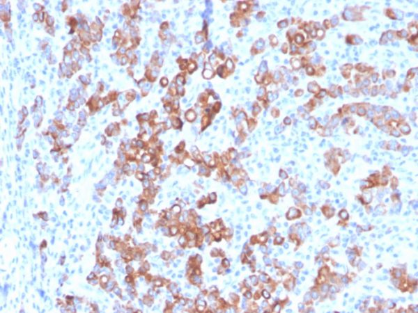 Formalin-fixed, paraffin-embedded human Adrenal stained with TIM3 Mouse Monoclonal Antibody (TIM3/3113).