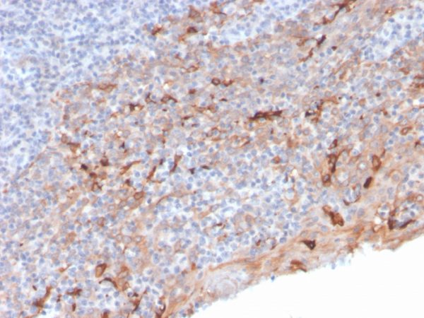 Formalin-fixed, paraffin-embedded human Tonsil stained with TIM3 Mouse Monoclonal Antibody (TIM3/3113).