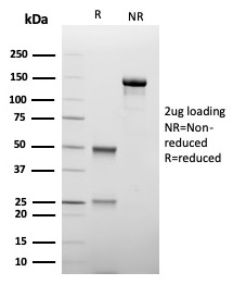 SDS-PAGE Analysis of Purified TIM3 Mouse Monoclonal Antibody (TIM3/4027). Confirmation of Integrity and Purity of Antibody.