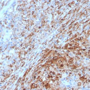 Formalin-fixed, paraffin-embedded human lymph node stained with TIM3 Mouse Monoclonal Antibody (TIM3/4029).