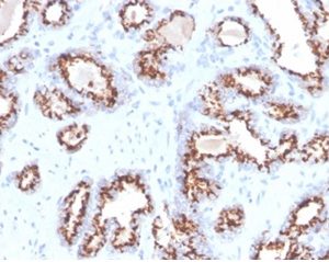 Formalin-fixed, paraffin-embedded human prostate stained with Prostein (p501S) Recombinant Rabbit Monoclonal Antibody (ZR9). HIER: Tris/EDTA, pH9.0, 45min. 2 °: HRP-polymer, 30min. DAB, 5min.