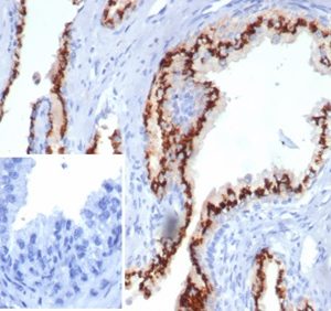 Formalin-fixed, paraffin-embedded human prostate stained with Prostein (p501S) Recombinant Rabbit Monoclonal Antibody (SLC45A3/7176R). Inset: PBS instead of primary antibody; secondary only negative control.
