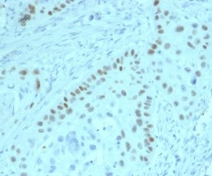 Formalin-fixed, paraffin-embedded human prostate stained with TP63 Mouse Monoclonal Antibody (PCRP-TP63-2G3).