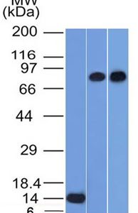 Western Blot of Recombinant, PC3 and HeLa cell lysates using p63 Mouse Monoclonal Antibody (TP63/1786).