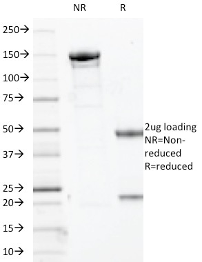 SDS-PAGE Analysis of Purified p63 Mouse Monoclonal Antibody (TP63/2427). Confirmation of Integrity and Purity of Antibody. p63 (Squamous, Basal & Myoepithelial Cell Marker) Antibody - Image 2