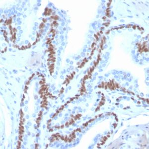 Formalin-fixed, paraffin-embedded human skin stained with  p40 Recombinant Rabbit Monoclonal Antibody (ZR8).