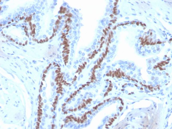 Formalin-fixed, paraffin-embedded human skin stained with  p40 Recombinant Rabbit Monoclonal Antibody (ZR8).