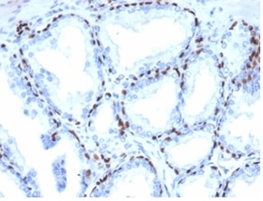 Formalin-fixed, paraffin-embedded human prostate stained with  p40 Recombinant Rabbit Monoclonal Antibody (P40/4396R).