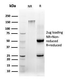 SDS-PAGE Analysis of Purified CBFB Mouse Monoclonal Antibody (PCRP-CBFB-1F6). Confirmation of Purity and Integrity of Antibody. CBFB / PEBP2β Antibody - Image 2