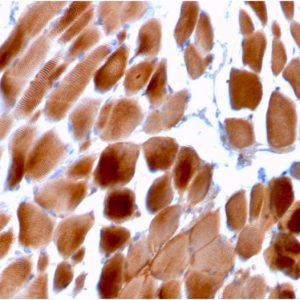 Formalin-fixed, paraffin-embedded human Cardiac Muscle stained with Sarcomeric Actinin Alpha 2 Mouse Monoclonal Antibody (ACTN2/3292).