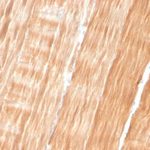 Formalin-fixed, paraffin-embedded human Skeletal Muscle stained with Sarcomeric Actinin Alpha 2 Mouse Monoclonal Antibody (ACTN2/3293).