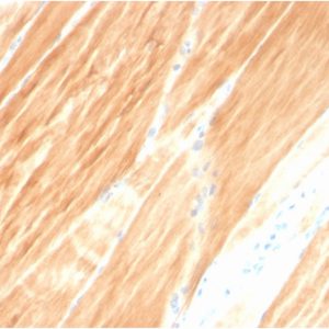 Formalin-fixed, paraffin-embedded human Skeletal Muscle stained with Sarcomeric Actinin Alpha 2 Mouse Monoclonal Antibody (ACTN2/3295).