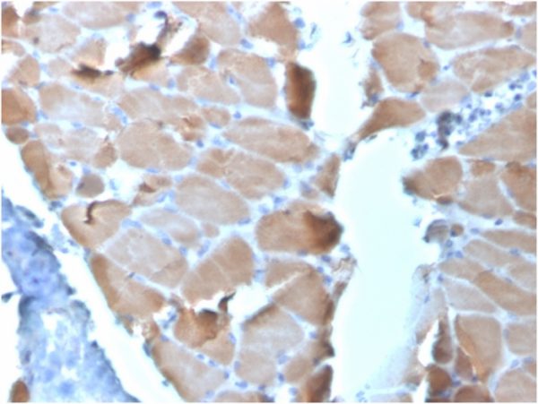 Formalin-fixed, paraffin-embedded human Cardiac Muscle stained with Sarcomeric Actinin Alpha 2 Mouse Monoclonal Antibody (ACTN2/3295).