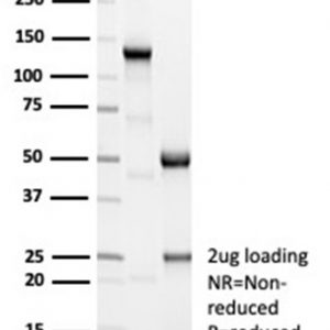 SDS-PAGE Analysis Purified ACTN2Rabbit Monoclonal Antibody (ACTN2/7039R). Confirmation of Purity and Integrity of Antibody.