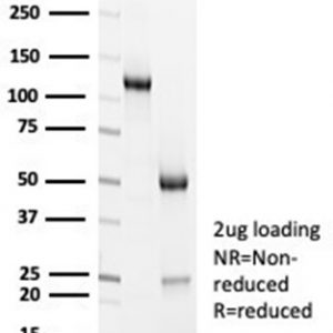 SDS-PAGE Analysis Purified ACTN2 Rabbit Monoclonal Antibody (ACTN2/7040R). Confirmation of Purity and Integrity of Antibody.