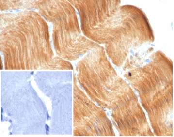 Formalin-fixed, paraffin-embedded human skeletal muscle stained with ACTN2 Rabbit Monoclonal Antibody (ACTN2/7040R). Inset: PBS instead of primary antibody; secondary only negative control.