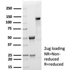 SDS-PAGE Analysis Purified ACTN2 Rabbit Monoclonal Antibody (ACTN2/7041R). Confirmation of Purity and Integrity of Antibody.