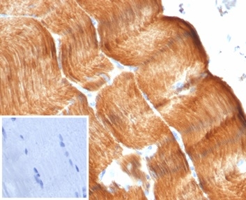 Formalin-fixed, paraffin-embedded human skeletal muscle stained with ACTN2 Rabbit Monoclonal Antibody (ACTN2/7041R). Inset: PBS instead of primary antibody; secondary only negative control.