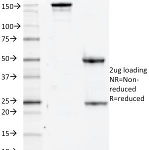 SDS-PAGE Analysis of Purified CD84 Mouse Monoclonal Antibody (152-1D5). Confirmation of Purity and Integrity of Antibody.