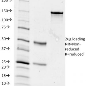 SDS-PAGE Analysis of Purified CD84 Mouse Monoclonal Antibody (153-4D9). Confirmation of Purity and Integrity of Antibody.