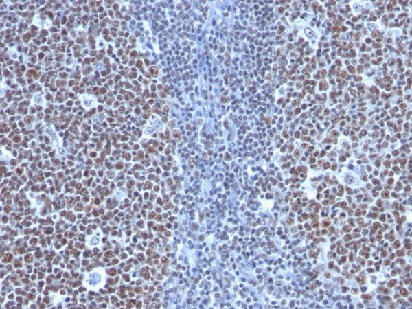 Formalin-fixed, paraffin-embedded human Tonsil stained with Cyclin B1 Monoclonal Antibody (SPM619)