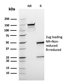 SDS-PAGE Analysis Purified BCL10 Recombinant Mouse Monoclonal Antibody (rBL10/411). Confirmation of Purity and Integrity of Antibody.