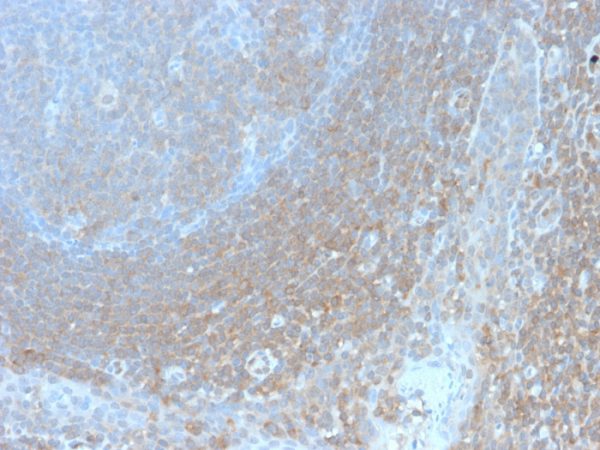 Formalin-fixed, paraffin-embedded human tonsil stained with BCL10 Recombinant Rabbit Monoclonal Antibody (BL10/2988R).