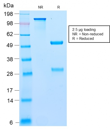 SDS-PAGE Analysis Purified BCL10 Recombinant Rabbit Monoclonal Antibody (BL10/2988R). Confirmation of Purity and Integrity of Antibody.