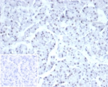 Formalin-fixed, paraffin-embedded human pancreas stained with PHOX2B Recombinant Rabbit Monoclonal Antibody (PHOX2B/7161R). Inset: PBS instead of primary antibody; secondary only negative control.