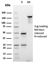 SDS-PAGE Analysis of Purified Cyclin E Mouse Monoclonal Antibody (CCNE1/2587). Confirmation of Integrity and Purity of Antibody.